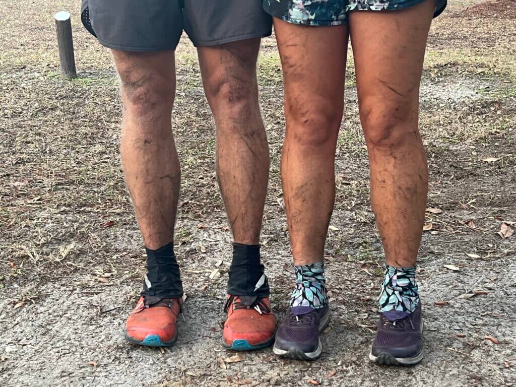 The aftermath of hiking through a controlled burn on the Florida Trail. The lovely smell of burnt leg hair and melted shoes can all be avoided with a little planning!